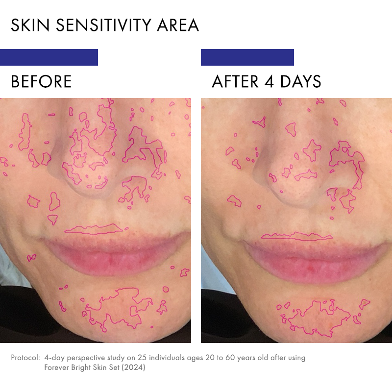 Bio-Active Skin Health System